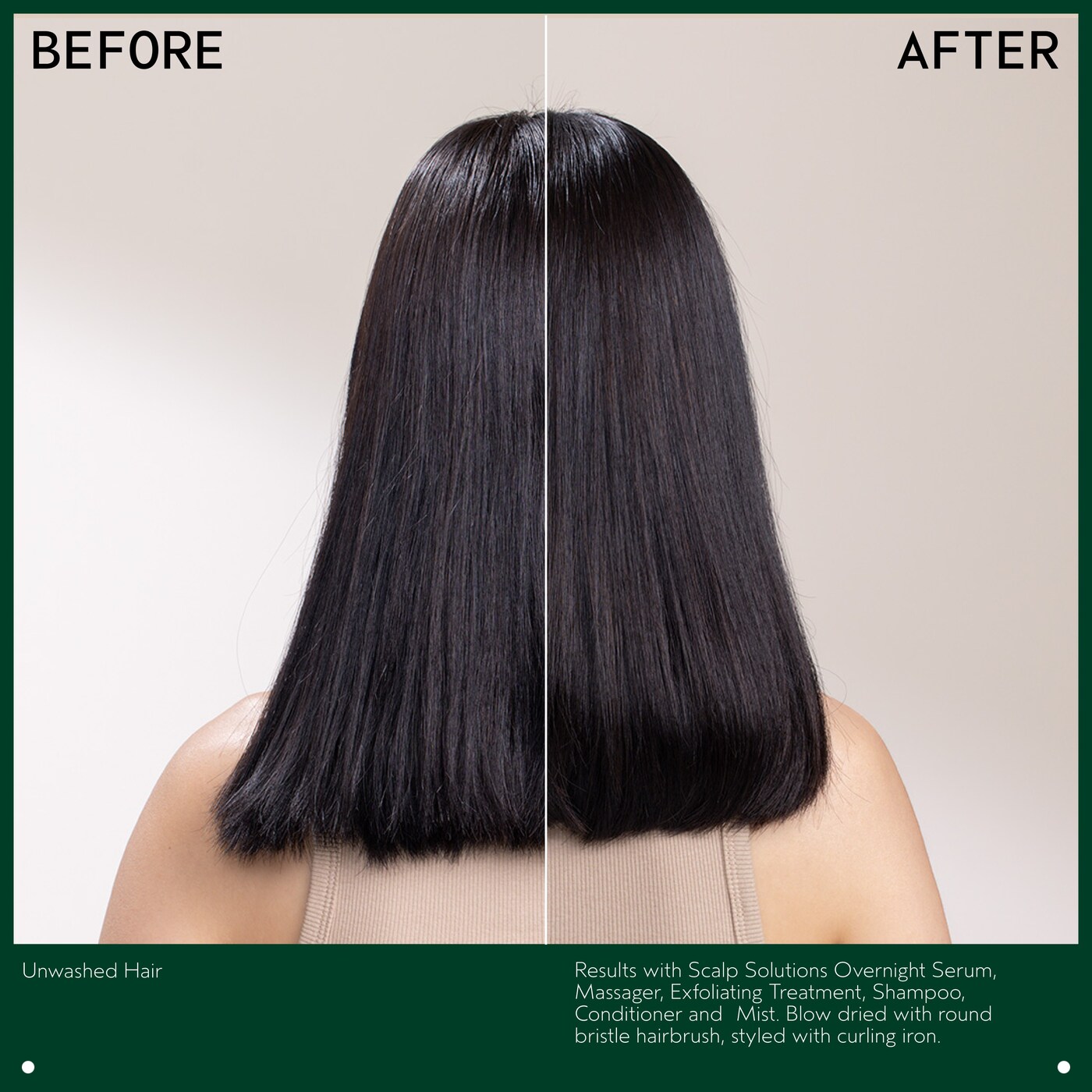 scalp solutions stimulating scalp massager