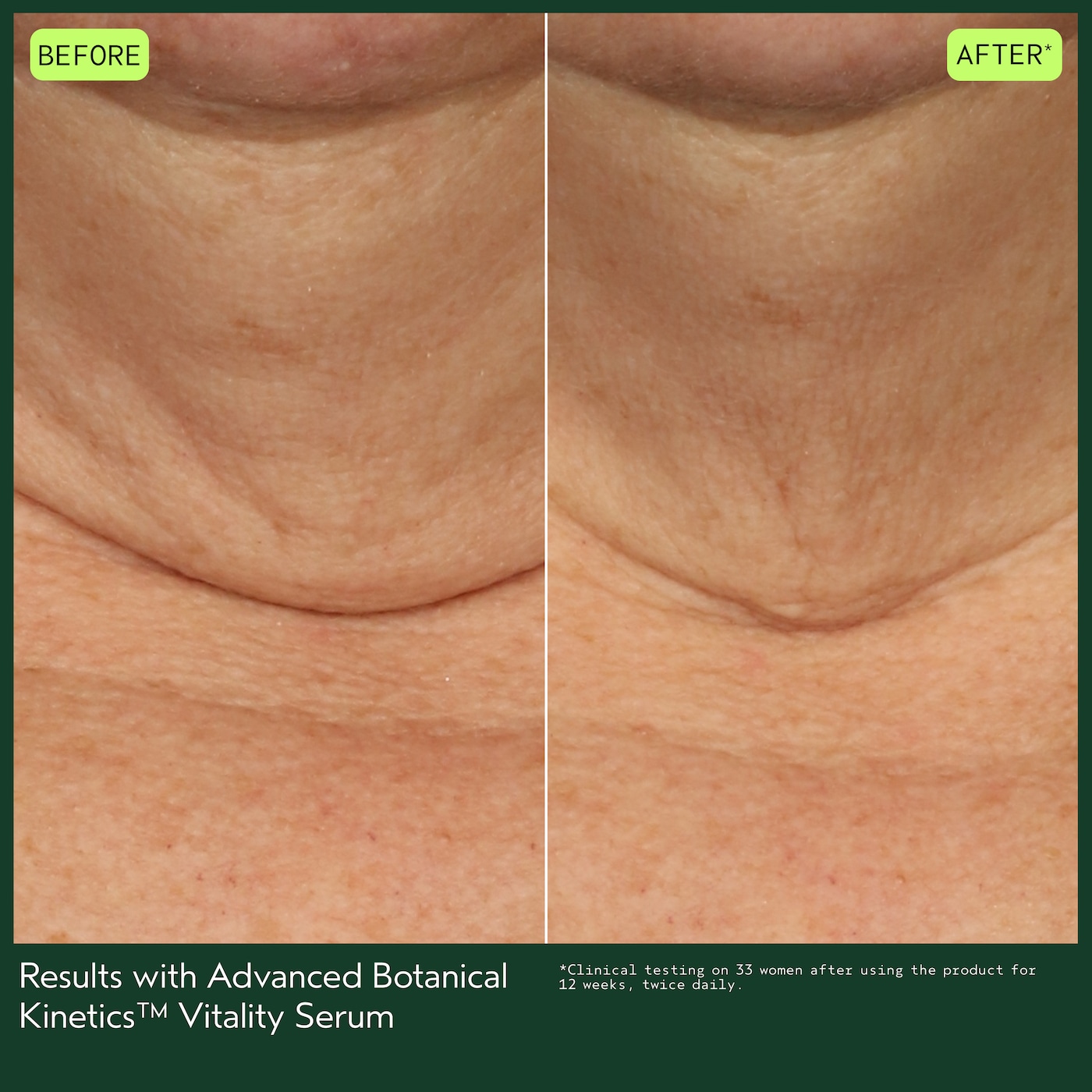 Advanced Botanical Kinetics™ Vitality Serum, 1 fl oz/30 ml